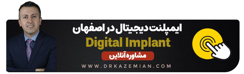 تماس برای کاشت دندان به روش دیجیتال در اصفهان
