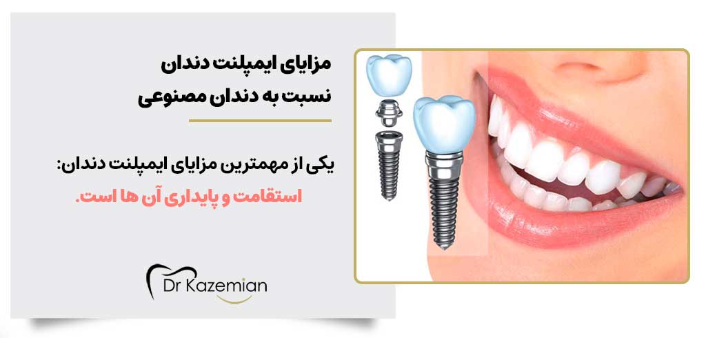 مزایای ایمپلنت دندان نسبت به دندان مصنوعی
