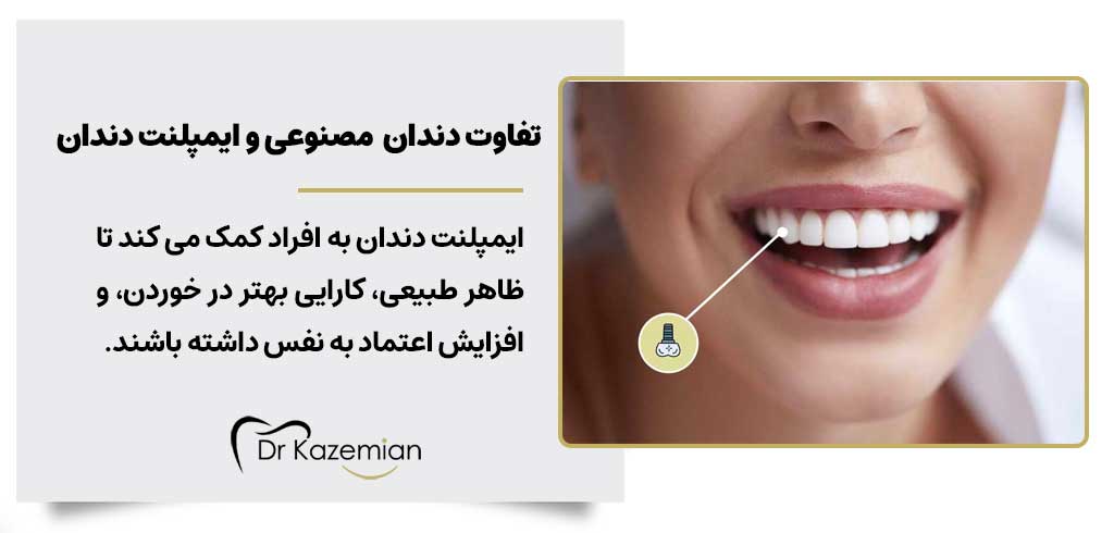 تفاوت دندان های مصنوعی و ایمپلنت دندان