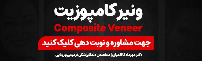 برای استعلام قیمت ونیرکامپوزیت در اصفهان تماس بگیرید.