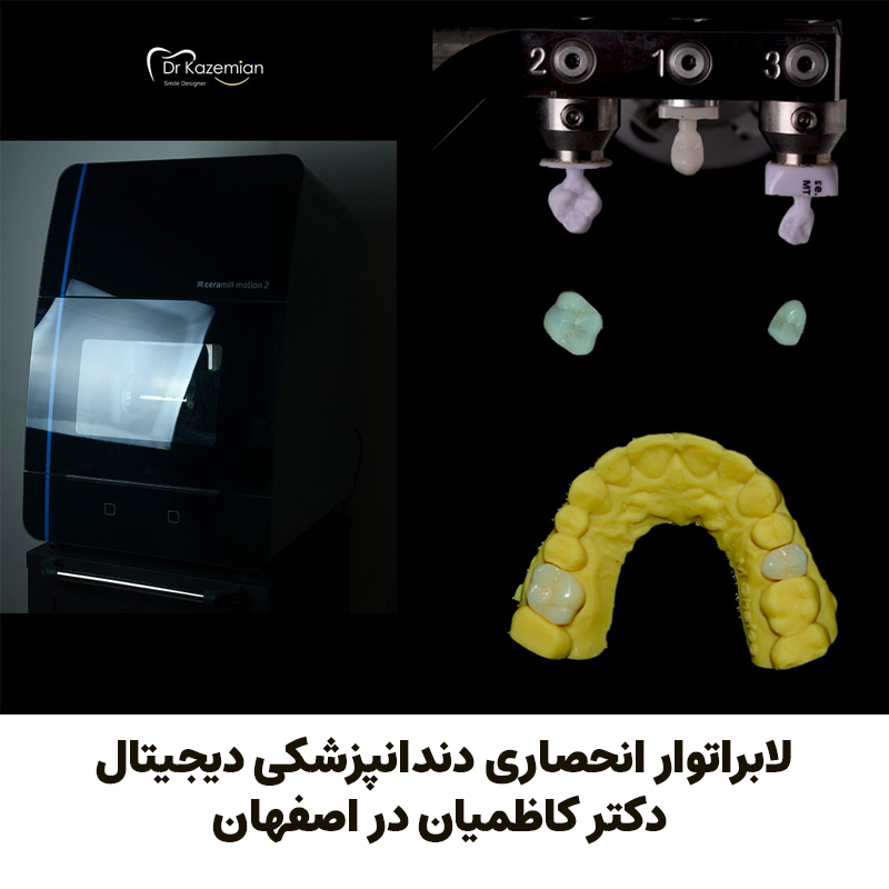 لابراتوار انحصاری دندانپزشکی دیجیتال دکتر کاظمیان در اصفهان