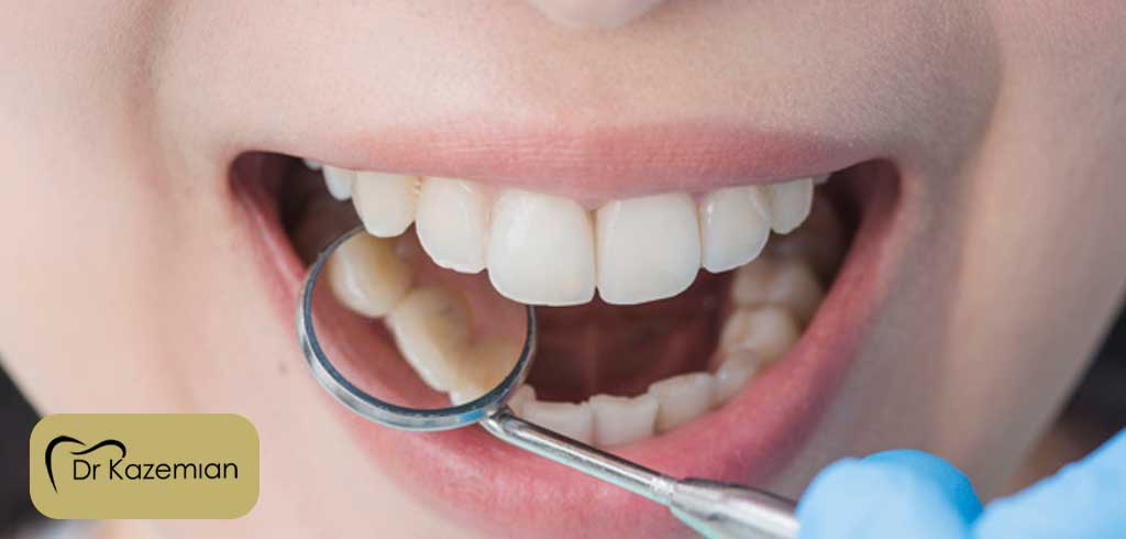 دلایل مراجعه به یک دندانپزشک زیبایی