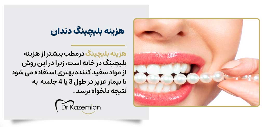 هزینه و قیمت بلیچینگ در اصفهان | دکتر کاظمیان دندانپزشک زیبایی در اصفهان