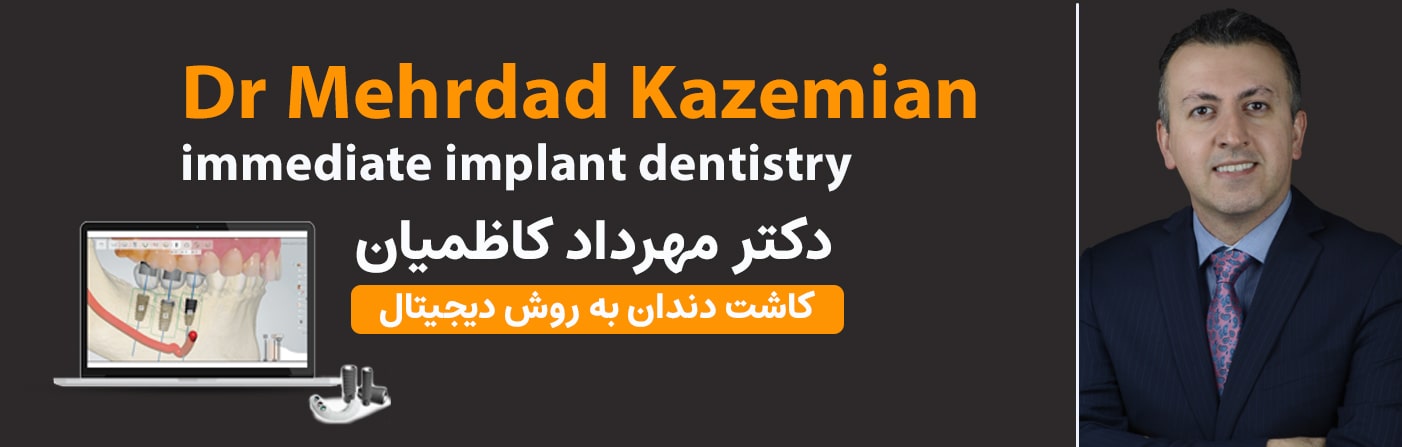 برای ایمپلنت دندان در اصفهان با بهترین متخصص ایمپلنت در اصفهان تماس بگیرید