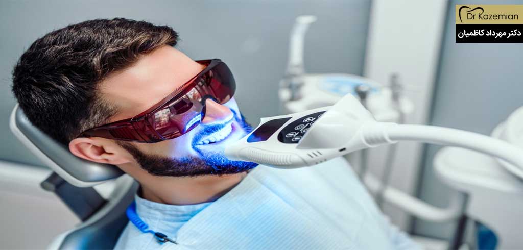بلیچینگ دندان | دکتر کاظمینان دندانپزشک زیبایی در اصفهان