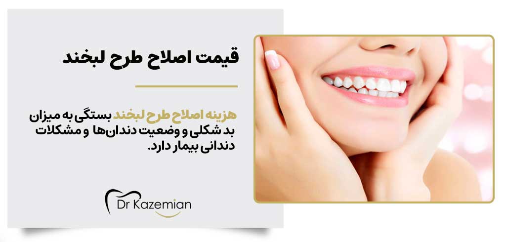 هزینه و اصلاح طرح لبخند در اصفهان | دکتر کاظمیان دندانپزشک زیبایی در اصفهان