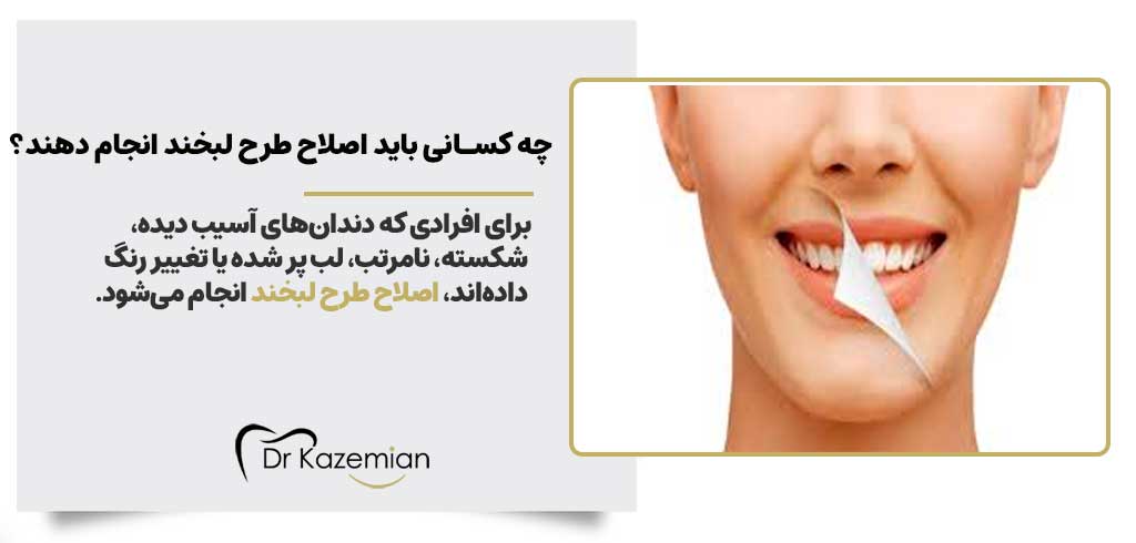 چه کسانی باید اصلاح طرح لبخند انجام دهند | دکتر مهرداد کاظمیان دندانپزشک زیبایی اصفهان