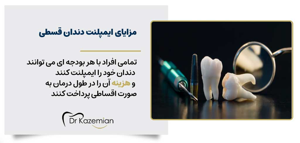 مزایای پرداخت هزینه ایمپلنت به صورت قسطی | دکتر کاظمیان در اصفهان