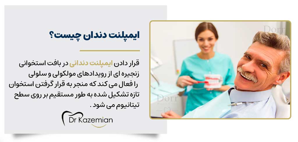 ایمپلنت اقساطی دندان در اصفهان | دکتر مهرداد کاظمیان دندانپزشک زیبایی در اصفهان