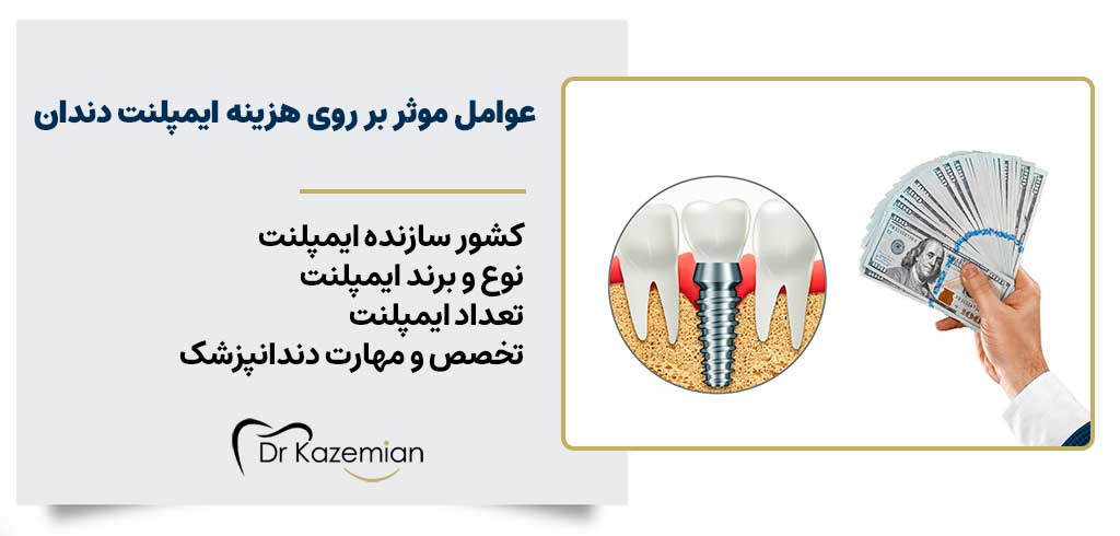 عوامل موثر و تاثیر گذار بر روی هزینه ایمپلنت در اصفهان | دکتر کاظمیان دندانپزشک زیبایی در اصفهان