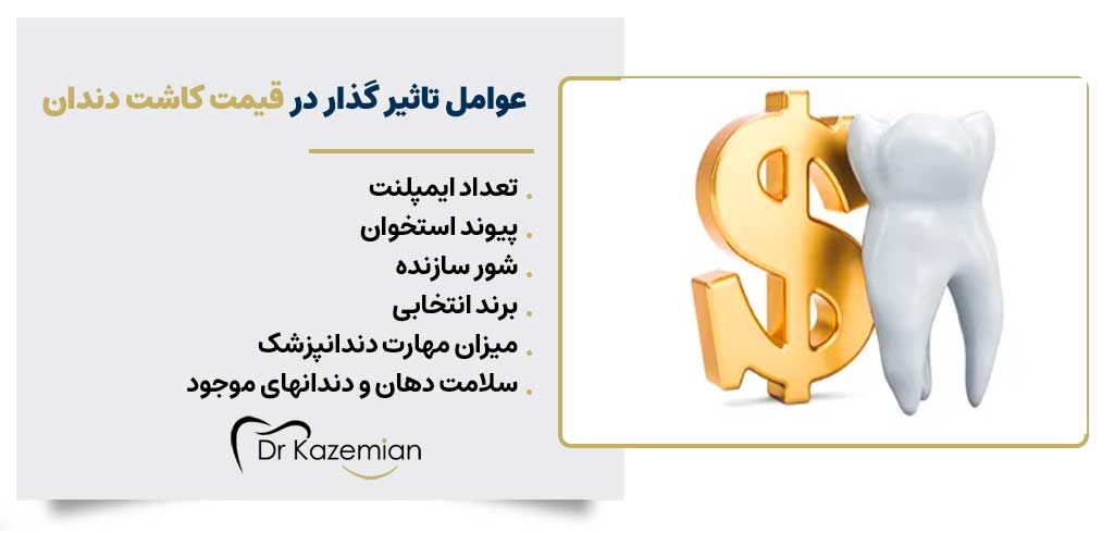 عوامل تاثیر گذار در قیمت کاشت دندان | دکتر کاظمینان دندانپزشک زیبایی در اصفهان