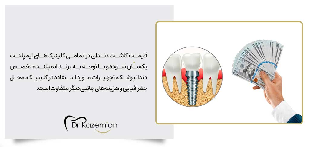 آیا هزینه‌ی کاشت دندان در مراکز ایمپلنت در اصفهان متفاوت است؟