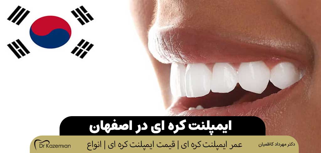 ایمپلنت کره ای در اصفهان | دکتر مهرداد کاظمیان دندانپزشک زیبایی در اصفهان