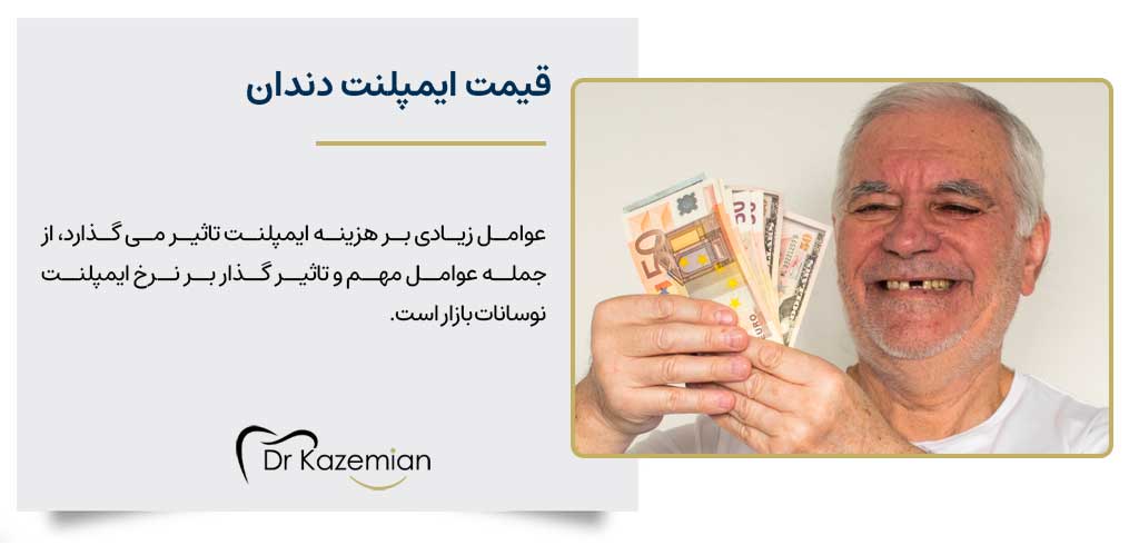 قیمت ایمپلنت دندان در اصفهان