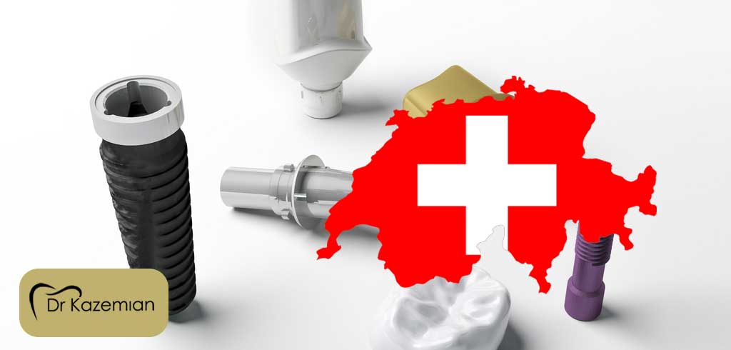 مزایای ایمپلنت سوئیسی