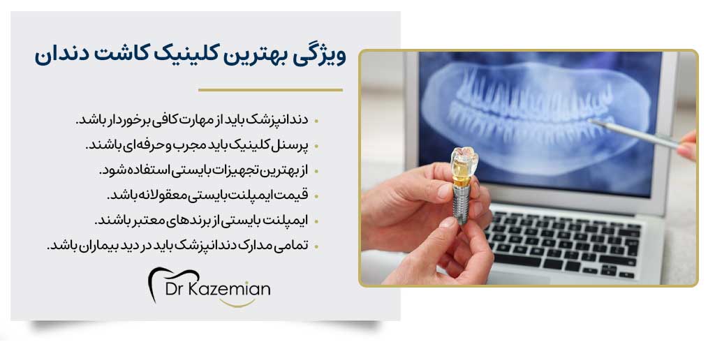 بهترین کلینیک کاشت دندان در اصفهان چه ویژگی‌هایی دارد؟