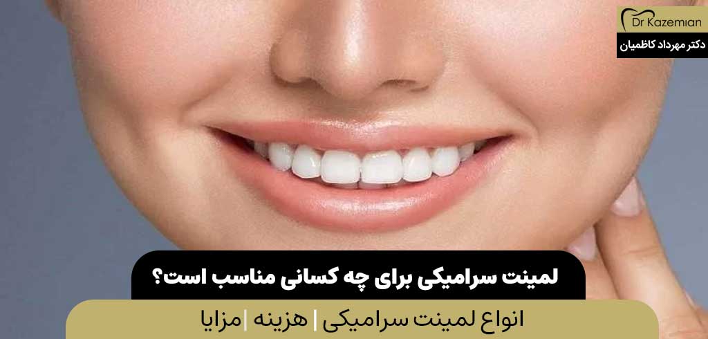 لمینت سرامیکی برای چه کسانی مناسب است؟ | دکتر کاظمیان دندانپزشک زیبایی در اصفهان