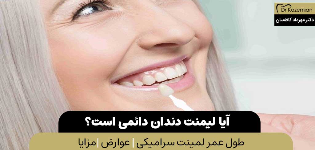 آیا لیمنت دندان دائمی است؟ | دکتر کاظمیان دندانپزشک زیبایی در اصفهان