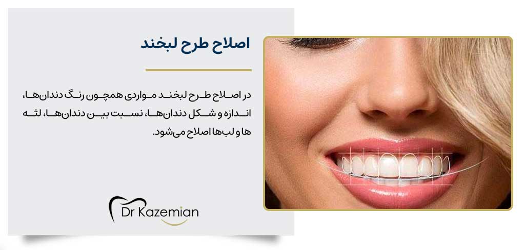 اصلاح طرح لبخند در اصفهان
