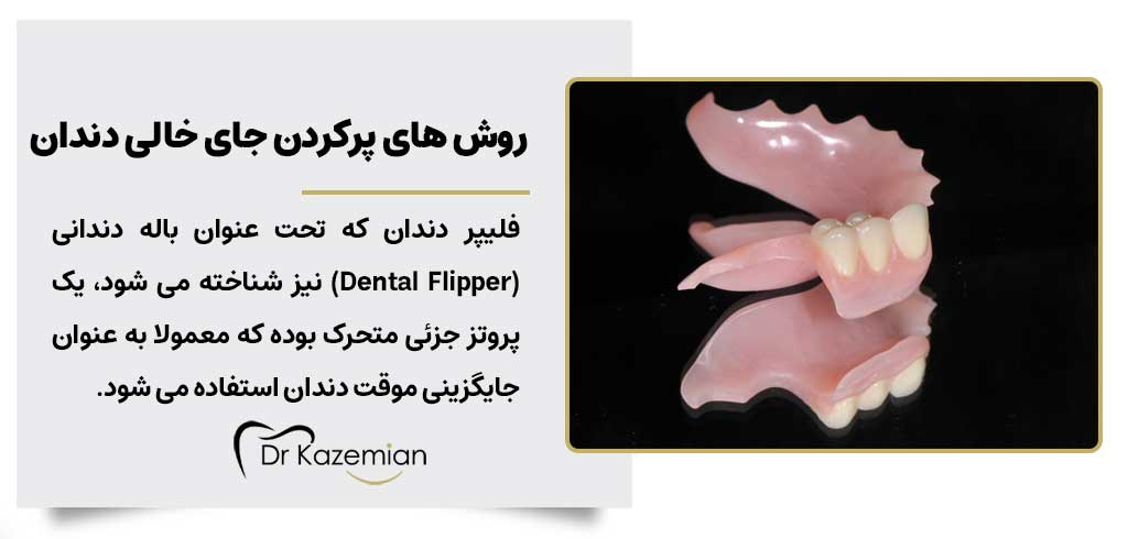 روش های پرکردن جای خالی دندان | فیلپر دندان