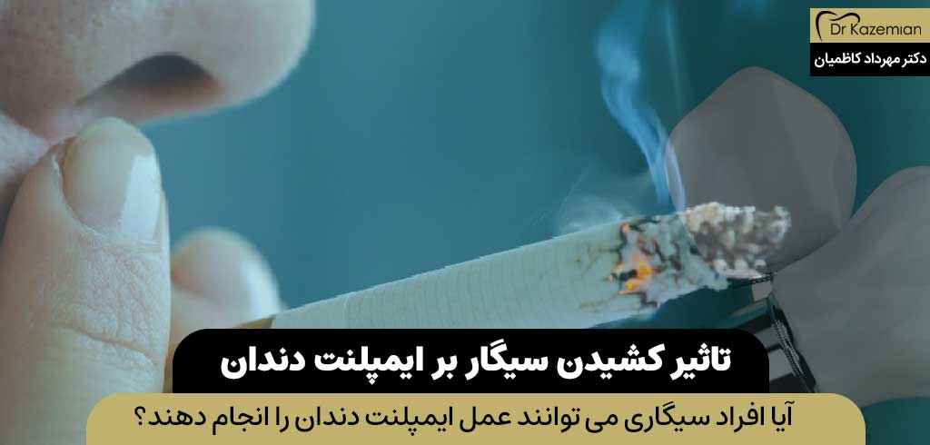 تاثیر کشیدن سیگار بر ایمپلنت دندان | ایمپلنت در افراد سیگاری