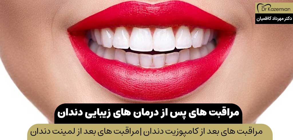 مراقبت های پس از درمان های زیبایی دندان